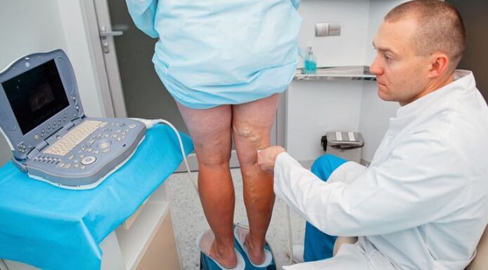 Diagnostika kŕčových žíl